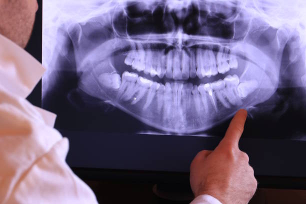 Best Emergency Gum Treatment in Big Lake, WA