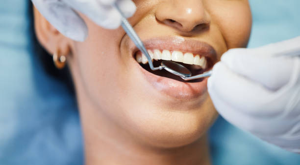 Best Emergency Treatment for Dental Infections or Abscesses in Big Lake, WA